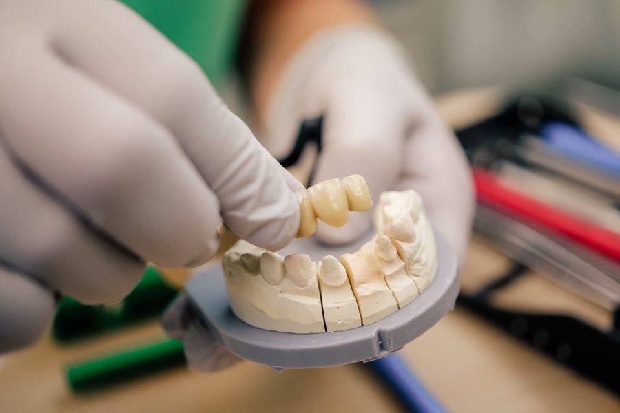 Gloved hands holding a dental model and a bridge